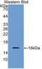 Inhibin Subunit Beta B antibody, LS-C294611, Lifespan Biosciences, Western Blot image 