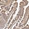 Sodium Channel Epithelial 1 Delta Subunit antibody, NBP1-85004, Novus Biologicals, Immunohistochemistry frozen image 