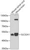 Solute Carrier Family 32 Member 1 antibody, GTX32964, GeneTex, Western Blot image 