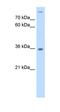 Eukaryotic Translation Initiation Factor 1A X-Linked antibody, orb325253, Biorbyt, Western Blot image 