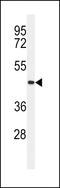 Transmembrane Protein 30B antibody, LS-C168375, Lifespan Biosciences, Western Blot image 