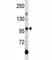 AXL Receptor Tyrosine Kinase antibody, F44438-0.4ML, NSJ Bioreagents, Western Blot image 