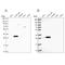 Ribosomal Protein L8 antibody, NBP2-47297, Novus Biologicals, Western Blot image 