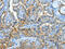 Annexin A3 antibody, CSB-PA556717, Cusabio, Immunohistochemistry paraffin image 
