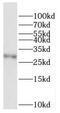 Coagulation Factor XII antibody, FNab02938, FineTest, Western Blot image 