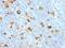 Clathrin Light Chain B antibody, orb387988, Biorbyt, Immunohistochemistry paraffin image 