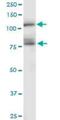 Cadherin 11 antibody, H00001009-M04, Novus Biologicals, Western Blot image 