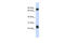Tetraspanin 8 antibody, ARP46477_P050, Aviva Systems Biology, Western Blot image 
