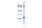 Tetraspanin-8 antibody, ARP46477_P050, Aviva Systems Biology, Western Blot image 