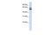 ALOX15B antibody, GTX47101, GeneTex, Western Blot image 