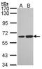 Sorting Nexin 18 antibody, PA5-21747, Invitrogen Antibodies, Western Blot image 