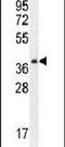 Serine Protease 3 antibody, PA5-23991, Invitrogen Antibodies, Western Blot image 