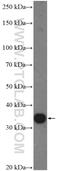 Actin Related Protein 2/3 Complex Inhibitor antibody, 26318-1-AP, Proteintech Group, Western Blot image 