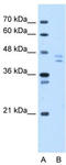 Proteasome 26S Subunit, Non-ATPase 11 antibody, TA330262, Origene, Western Blot image 