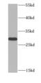 Methylthioadenosine Phosphorylase antibody, FNab05391, FineTest, Western Blot image 