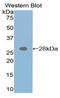 Retinoic Acid Receptor Alpha antibody, LS-C296233, Lifespan Biosciences, Western Blot image 