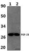 Fibroblast Growth Factor 23 antibody, GTX66836, GeneTex, Western Blot image 
