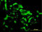 Eukaryotic Translation Initiation Factor 4E Family Member 2 antibody, LS-C133590, Lifespan Biosciences, Immunofluorescence image 