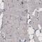 CD142 antibody, NBP2-61640, Novus Biologicals, Immunohistochemistry paraffin image 