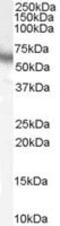 Ribosomal Protein S6 Kinase B1 antibody, MBS420164, MyBioSource, Western Blot image 