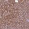 Protein Kinase C Substrate 80K-H antibody, NBP2-38492, Novus Biologicals, Immunohistochemistry frozen image 