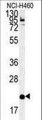 SLAM Family Member 7 antibody, LS-C161117, Lifespan Biosciences, Western Blot image 