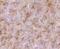 Transferrin Receptor 2 antibody, A02353, Boster Biological Technology, Immunohistochemistry frozen image 