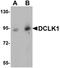 Doublecortin Like Kinase 1 antibody, orb75373, Biorbyt, Western Blot image 