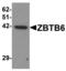 Zinc Finger And BTB Domain Containing 6 antibody, LS-B7025, Lifespan Biosciences, Western Blot image 