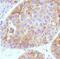 Alpha Fetoprotein antibody, MA5-16321, Invitrogen Antibodies, Immunohistochemistry paraffin image 