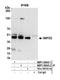 SET And MYND Domain Containing 2 antibody, NBP1-50043, Novus Biologicals, Western Blot image 