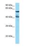 Endothelial Cell Adhesion Molecule antibody, NBP1-98329, Novus Biologicals, Western Blot image 