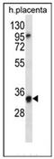 Olfactory Receptor Family 6 Subfamily N Member 2 antibody, AP53098PU-N, Origene, Western Blot image 