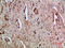 C-X-C Motif Chemokine Ligand 5 antibody, A00946-1, Boster Biological Technology, Immunohistochemistry frozen image 