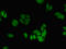 6-Phosphofructo-2-Kinase/Fructose-2,6-Biphosphatase 2 antibody, orb46887, Biorbyt, Immunofluorescence image 