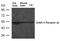 Gamma-Aminobutyric Acid Type A Receptor Alpha3 Subunit antibody, 79-658, ProSci, Western Blot image 