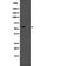 tRNA-splicing endonuclease subunit Sen2 antibody, abx215168, Abbexa, Western Blot image 