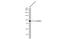 C1 esterase inhibitor antibody, GTX119690, GeneTex, Western Blot image 