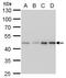 Mitogen-Activated Protein Kinase Kinase 2 antibody, GTX630541, GeneTex, Western Blot image 