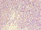 Gamma-Aminobutyric Acid Type A Receptor Rho1 Subunit antibody, LS-C675785, Lifespan Biosciences, Immunohistochemistry paraffin image 