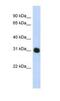 Proteasome Activator Subunit 3 antibody, NBP1-54587, Novus Biologicals, Western Blot image 