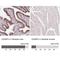 CD2 Cytoplasmic Tail Binding Protein 2 antibody, NBP2-49328, Novus Biologicals, Immunohistochemistry paraffin image 