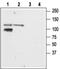 Glutamate Ionotropic Receptor Kainate Type Subunit 2 antibody, PA5-77418, Invitrogen Antibodies, Western Blot image 