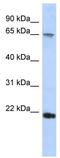 Fibrinogen Silencer Binding Protein antibody, TA331163, Origene, Western Blot image 