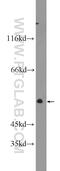 Transforming Growth Factor Beta Receptor 1 antibody, 55391-1-AP, Proteintech Group, Western Blot image 