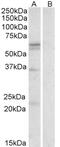 Placental Growth Factor antibody, 42-184, ProSci, Enzyme Linked Immunosorbent Assay image 