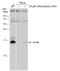 Microtubule Associated Protein 1 Light Chain 3 Alpha antibody, GTX132889, GeneTex, Western Blot image 