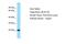 Biogenesis Of Lysosomal Organelles Complex 1 Subunit 3 antibody, NBP1-98303, Novus Biologicals, Western Blot image 