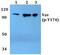 Vav Guanine Nucleotide Exchange Factor 1 antibody, PA5-36699, Invitrogen Antibodies, Western Blot image 