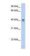 G Protein Subunit Alpha 12 antibody, NBP1-55321, Novus Biologicals, Western Blot image 